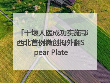 十堰人医成功实施鄂西北首例微创拇外翻Spear Plate髓内板矫形术